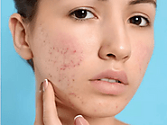 Best Dermatologist in Lucknow