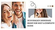 Is Invisalign Moderate Right for You? A Complete Guide