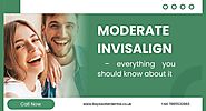 Moderate Invisalign – things you should know