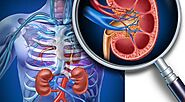 Top Kidney Specialist in Pune | CKD Specialist | Dr. Sandeep Morkhandikar | Fertiprotect and Superspeciality Centre