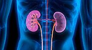 Kidney Transplant in Pune | Renal Failure | Dr. Sandeep Morkhandikar | Fertiprotect and Superspeciality Centre