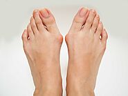 Updated by fodterapeut astawanti on Sep 19, 2024 Learn about bunions, their causes, symptoms, and the available treat...