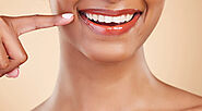 Teeth Whitening: What to Expect During a Professional Treatment