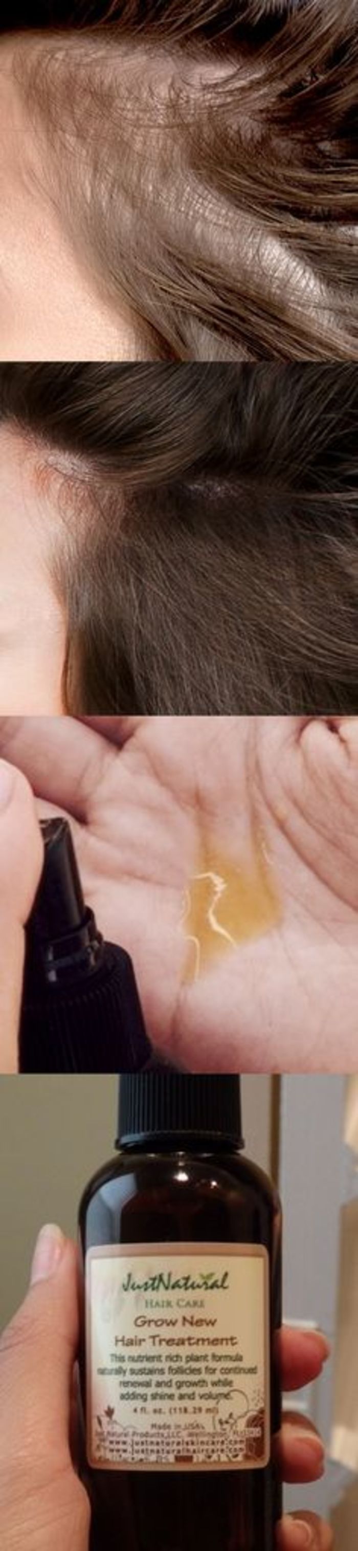 Best Products For Thinning Hair For Women A Listly List