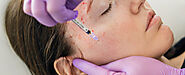 Vampire Facial: Harness the Power of PRP for Stunning Skin Results"