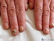 Comprehensive Nail Care for Healthier, Stronger Nails