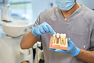 The Life-Changing Benefits of Dental Implants for a Healthier Smile