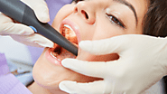 How to Care for Your Tooth After a Root Canal: A Comprehensive Guide