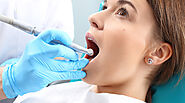 Signs You Might Need a Root Canal: Early Warning Indicators