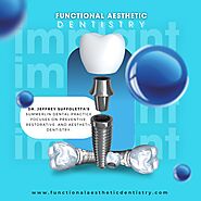 Experience Superior Dental Implant Solutions in Summerlin at Functional Aesthetic Dentistry