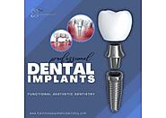 Experience Superior Dental Implant Solutions in Summerlin at Functional Aesthetic Dentistry