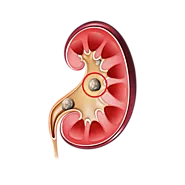 Best Kidney Stones Treatment in Ahmedabad - Dr. Rohan Patel