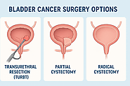 India's Bladder Cancer Surgery Options: What You Need to Know