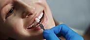 Best Dental Veneers Treatment in Chennai | Smile correction treatment in Chennai | Peakdentistryai.com