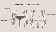 14 Things You Need to Know About Brazilian Laser Hair Removal