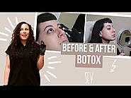 BOTOX Injections | Professional BOTOX Treatment | SEV Laser