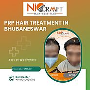 Best PRP Hair Treatment in Bhubaneswar in 2024