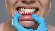 The Early Signs of Gum Disease: What You Need to Watch Out For