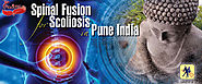 Spinal Fusion | Spine Surgery | Scoliosis | Spine Surgery for Scoliosis | Lumbar Fusion | Costs for Spinal Fusion | S...
