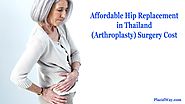 Hip Replacement (Arthroplasty) Surgery Cost in Thailand | Placid Answer