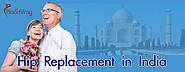 Hip Replacement in India