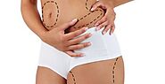 Liposuction Surgery Cost in Delhi, NCR - Dr Rajat Gupta