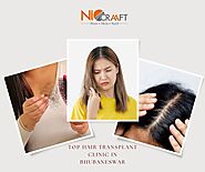 Top Hair Transplant Clinic in Bhubaneswar | Niocraaft