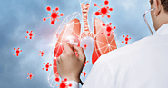 Respiratory Diseases: Symptoms & Ayurvedic Treatment