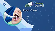 Root Canal Treatment | Tooth Root Canal Therapy in Calgary - Galaxy Dental