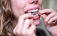 Invisalign vs Braces | Cameron Park Family Dentistry