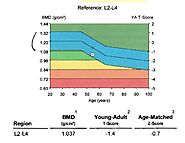 Osteopenia & Osteoporosis - Basic Science - Orthobullets