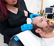 Hair Restoration at Renew You | Get Alma TED Hair Assessment