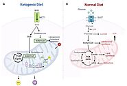 Ketogenic Diet Plus Resistance Training Applied to Physio-Pathological Conditions: A Brief Review