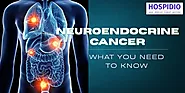 Neuroendocrine Tumors: Causes, Diagnosis, and Treatment | HOSPIDIO