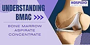 Revolutionizing Joint Repair with Bone Marrow Aspirate Concentrate (BMAC)