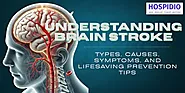 Understanding Brain Stroke: Types, Causes, Symptoms, and Treatment Options