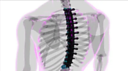 Spinal Scoliosis Surgery cost in India | HOSPIDIO