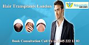 Best Hair Transplant London - Rejuvenate Hair Clinics