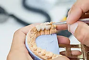 How Long Do Dental Crowns Last? | Cameron Park Family Dentistry