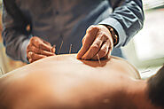 Acupuncture in Edmonton