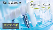 Dental Implants Implant Dentistry | Fountain Valley Dental