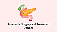 Advanced Pancreatic Surgery and Care in Ahmedabad!