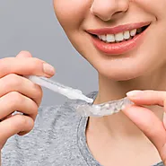 Professional Teeth Whitening in Kitchener