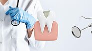 Tooth Filling in Dubai | Best Composite Dental Filling