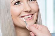 Achieving a Perfect Smile with Natural-Looking Veneers