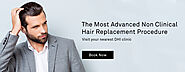 Hair Replacement in Chandigarh – Expectations Surpassed at DHI