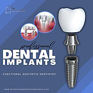 Experience Superior Dental Implant Solutions in Summerlin at Functional Aesthetic Dentistry