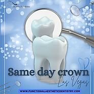 Same-Day Crowns in Las Vegas at Functional Aesthetic Dentistry