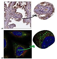 Immunohistochemistry (IHC) Market to Reach USD 7.4 Billion by 2034, Driven by a 7.8% CAGR – Market Research Blog