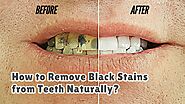 How to Remove Black Stains from Teeth Naturally? - SellersBay India